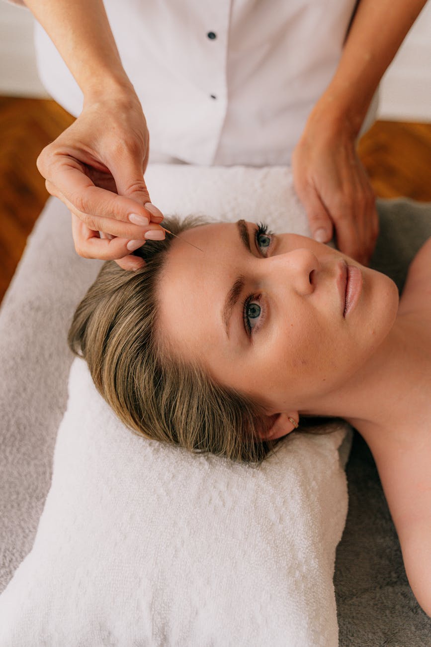 a person applying acupuncture needle on client s forehead